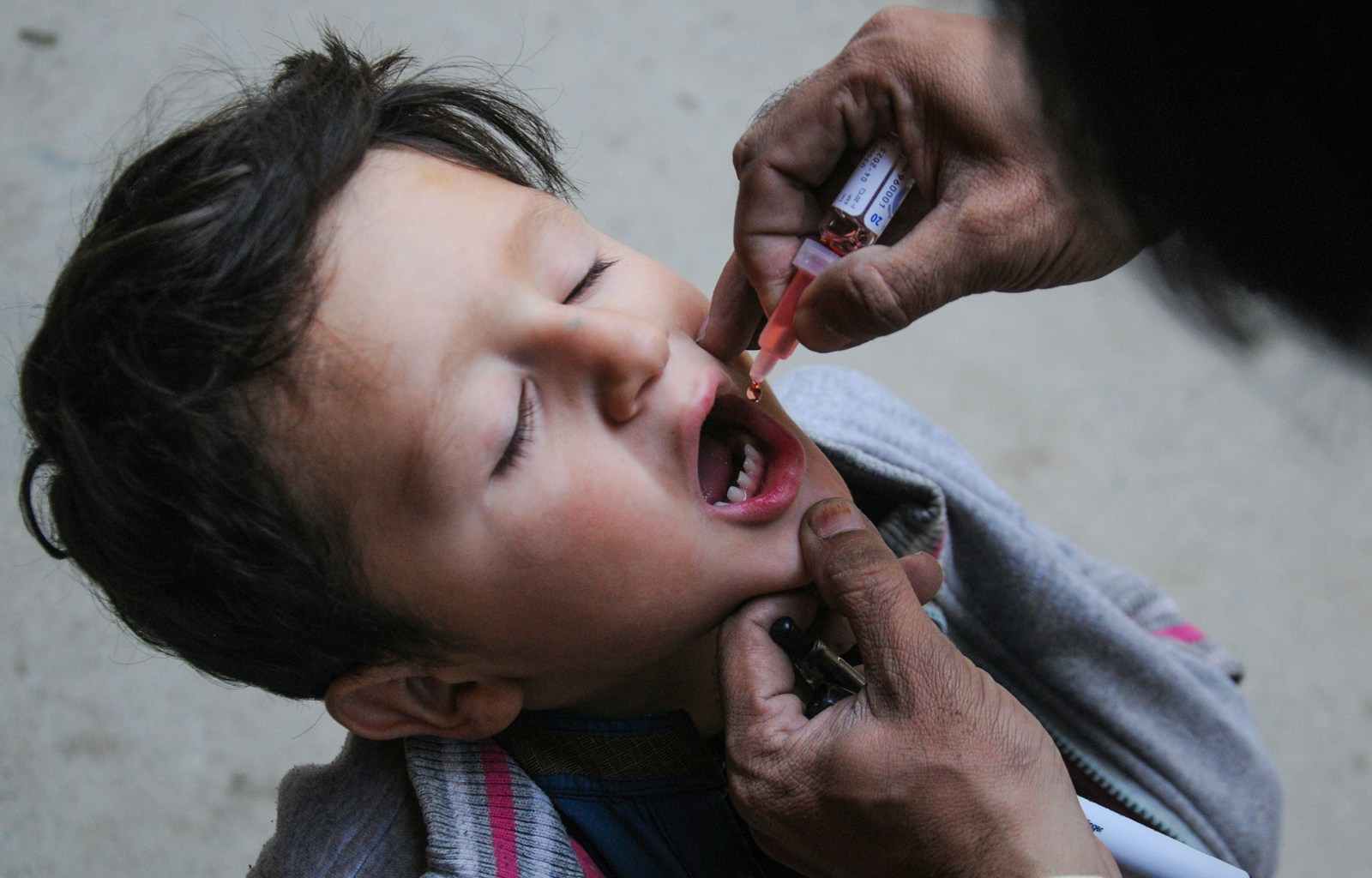 Caring for Your Child’s Teeth: Dental Tips for Every Age Group